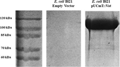 The Vacuolating Autotransporter Toxin (Vat) of Escherichia coli Causes Cell Cytoskeleton Changes and Produces Non-lysosomal Vacuole Formation in Bladder Epithelial Cells